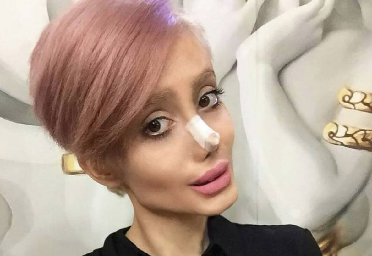 Instagram star who had plastic surgery to make her look like Angelina Jolie arrested ...1184 x 814