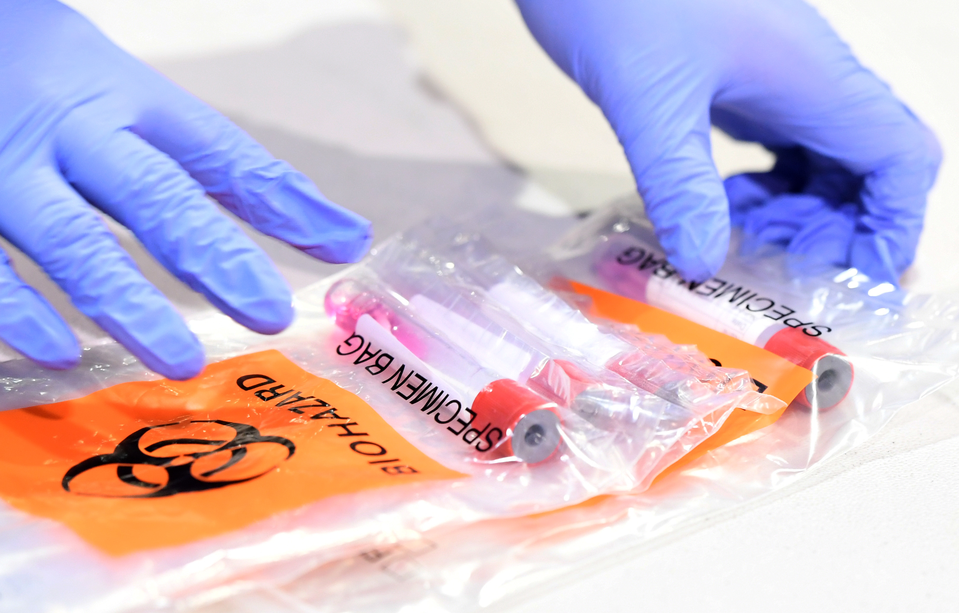 Respiratory therapist Diana Vega from University Medical Center of Southern Nevada collects coronavirus (COVID-19) tests in specimen sampling tubes during a preview of a new COVID-19 testing site inside Cashman Center on August 3, 2020 in Las Vegas, Nevada. (Ethan Miller/Getty Images)