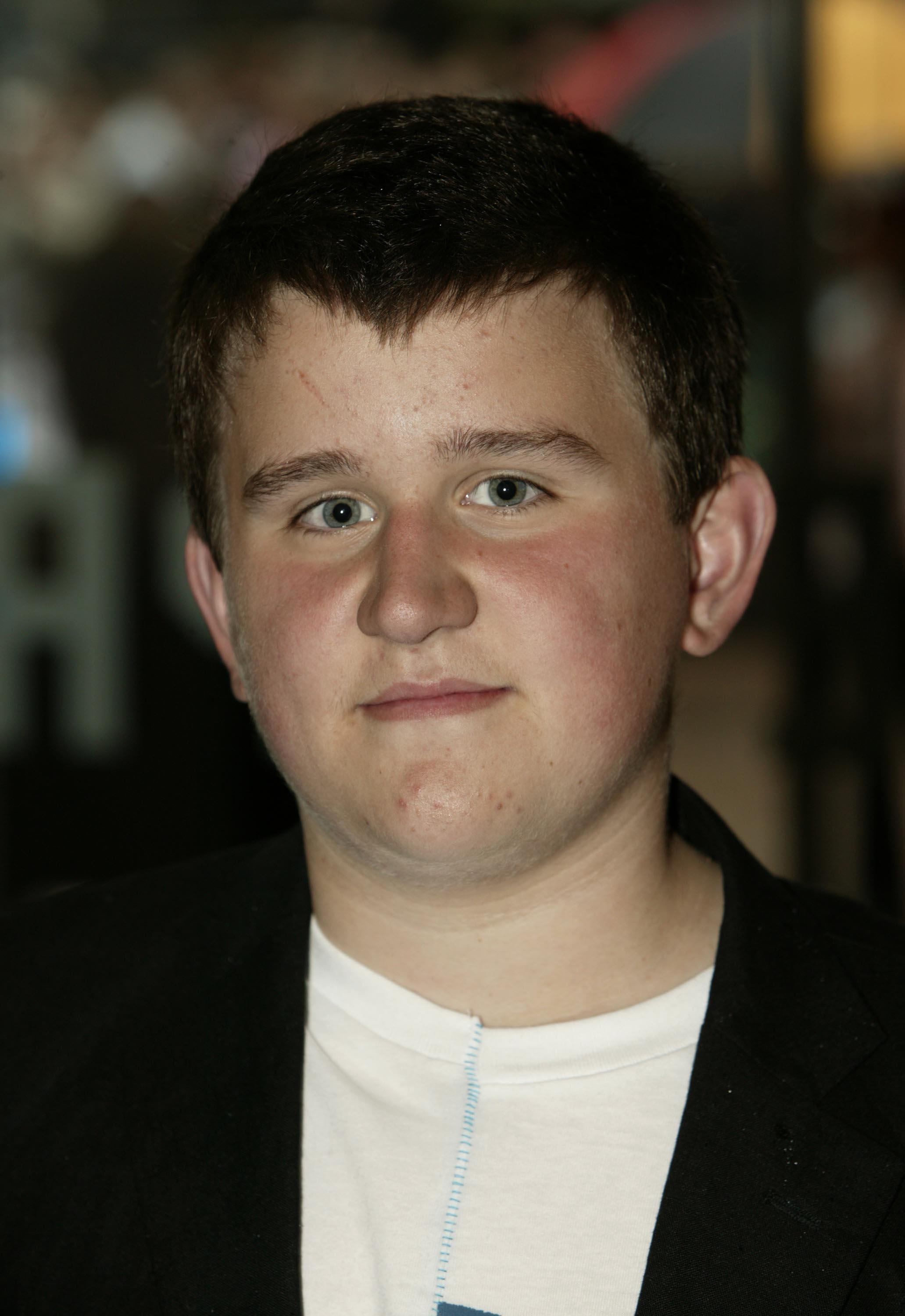 Harry Melling says it is a 'blessing' he no longer gets recognised by ...